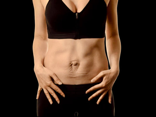 Postparto 11: Test de Díastasis